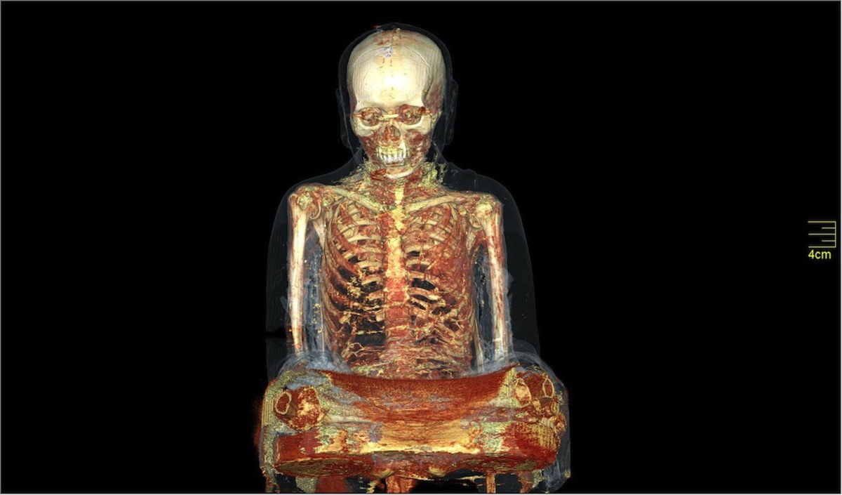 Компьютерная томография золотой статуи (1000-летний мумифицированный монах, спрятанный в статуе - CNN).
