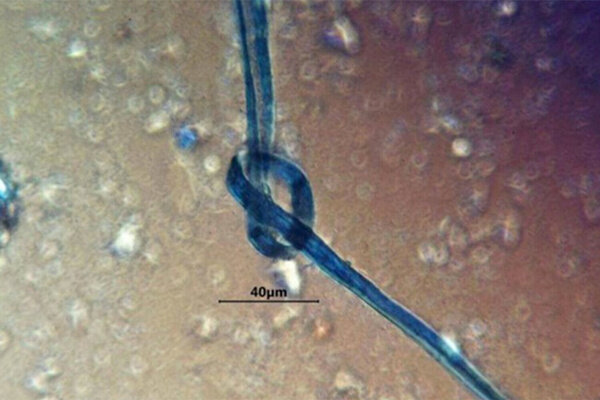 Хлопковые волокна в зубах жертв майя. Обложка © PaleoResearch Institute / Linda Scott Cummings