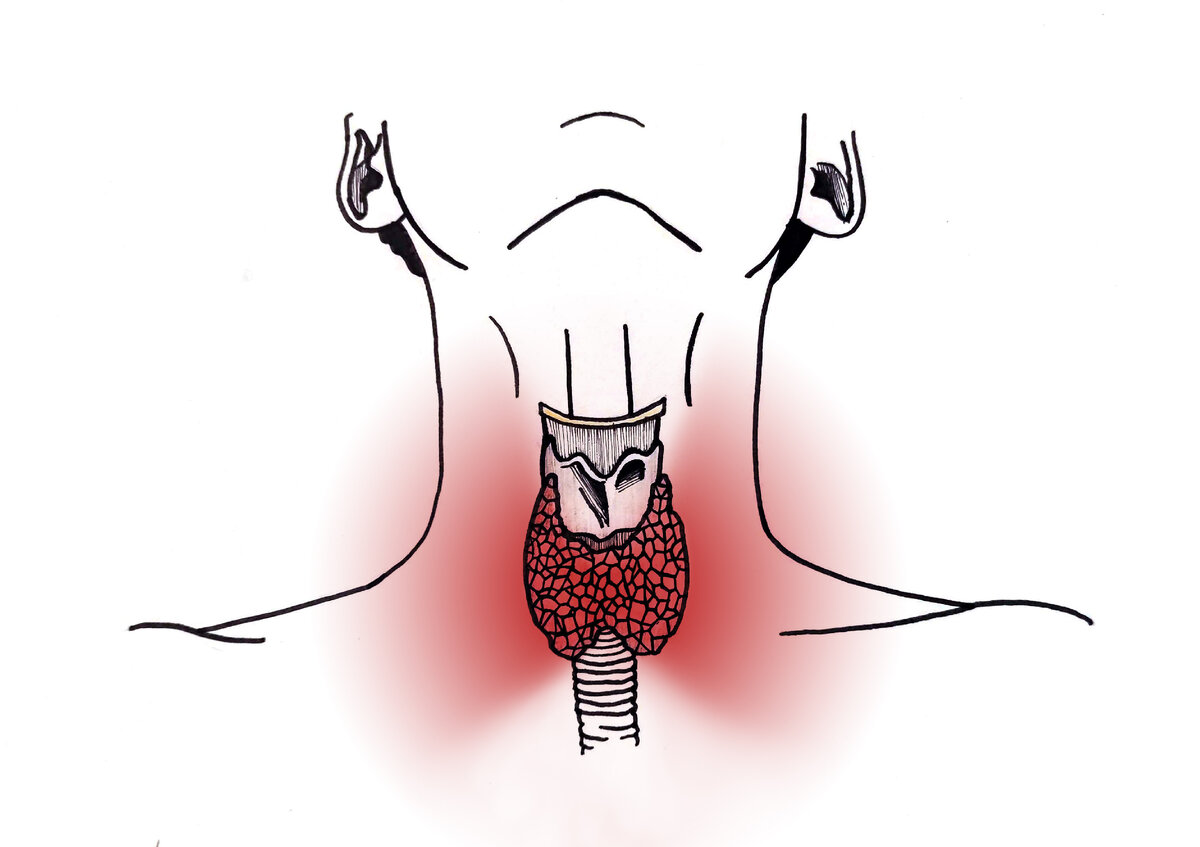 Рисунок 1- Расположение щитовидной железы 