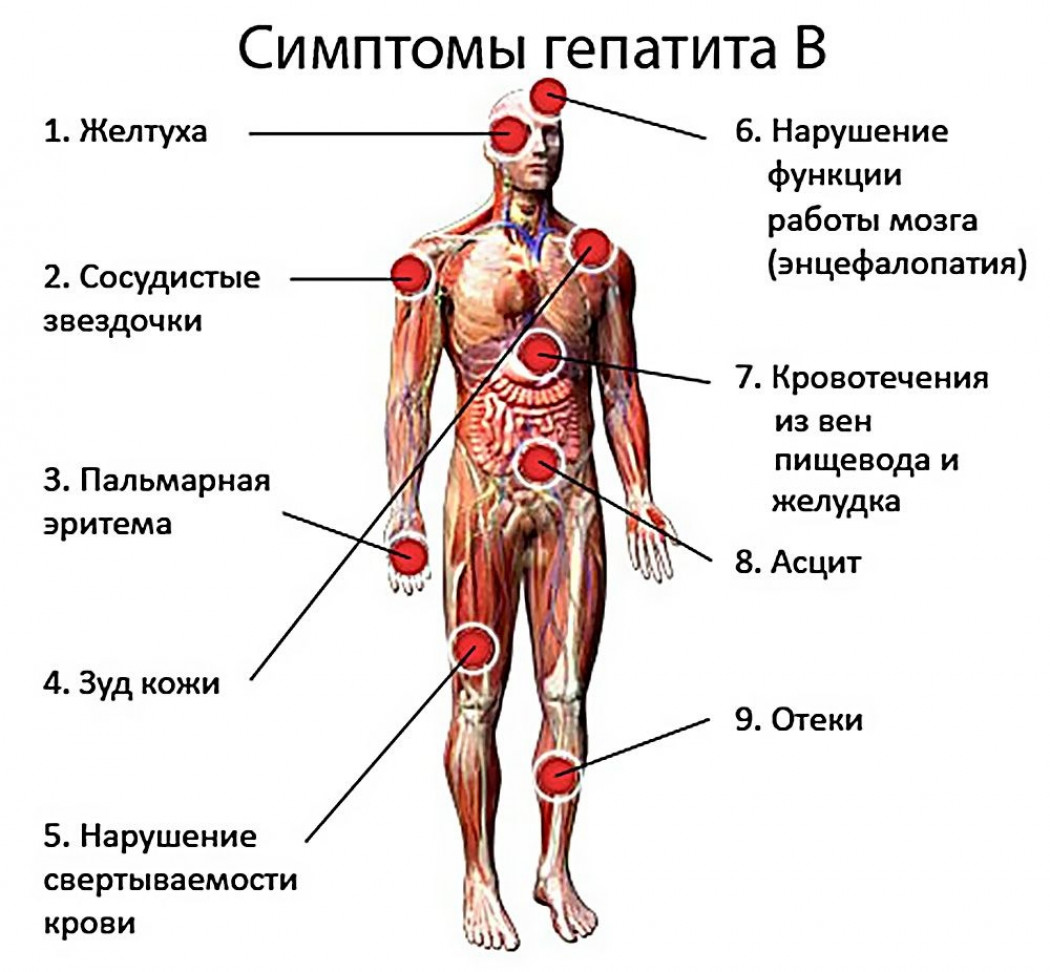 Лимфома брюшной полости