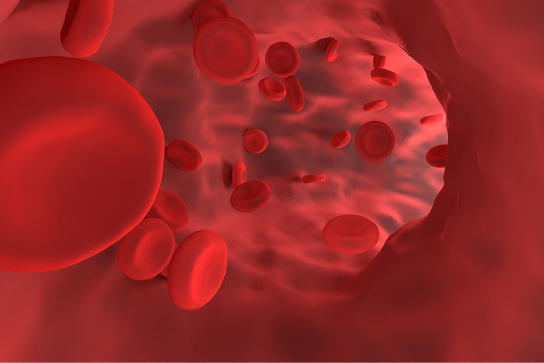 Как повысить гемоглобин — продукты и питание | Блог компании «Лина»