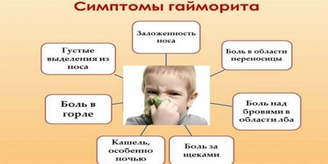 Симптомы гайморита. 