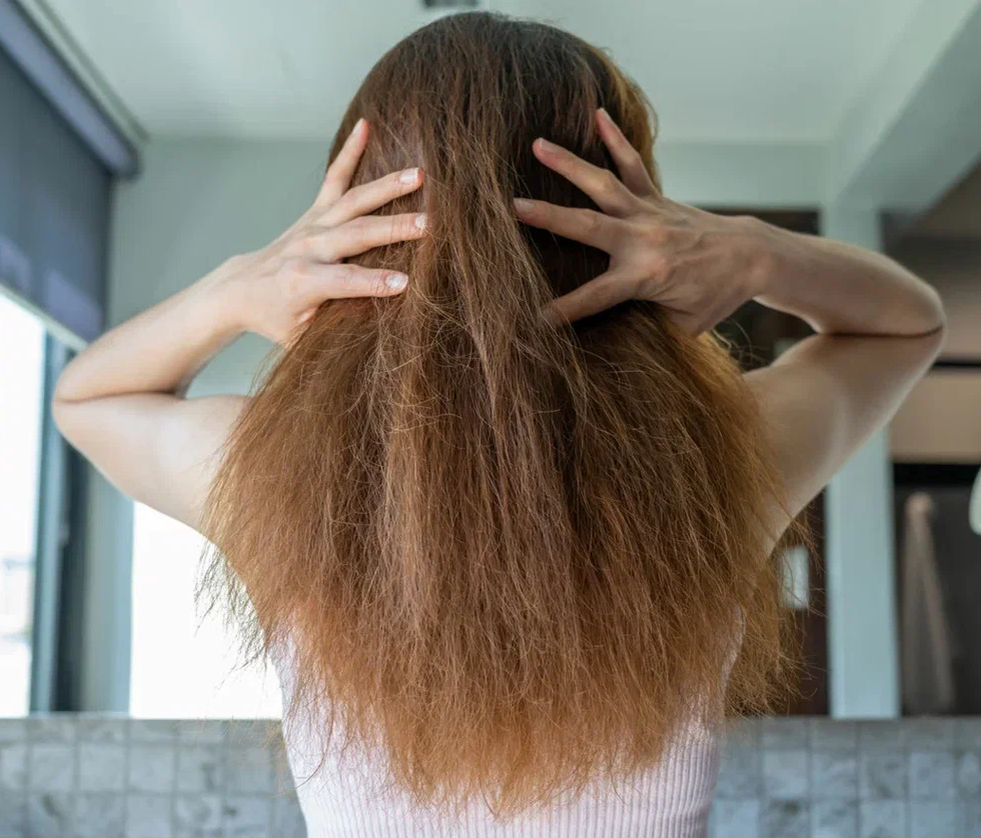 Укрепление волос на голове у женщин при выпадении - Клиника «Доктор Волос»