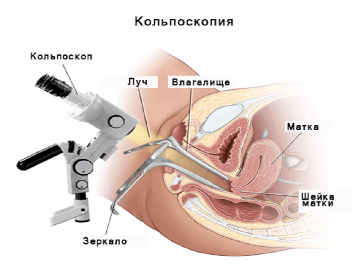 Гинекологические зеркала - купить в интернет-магазине Медтехно в Москве