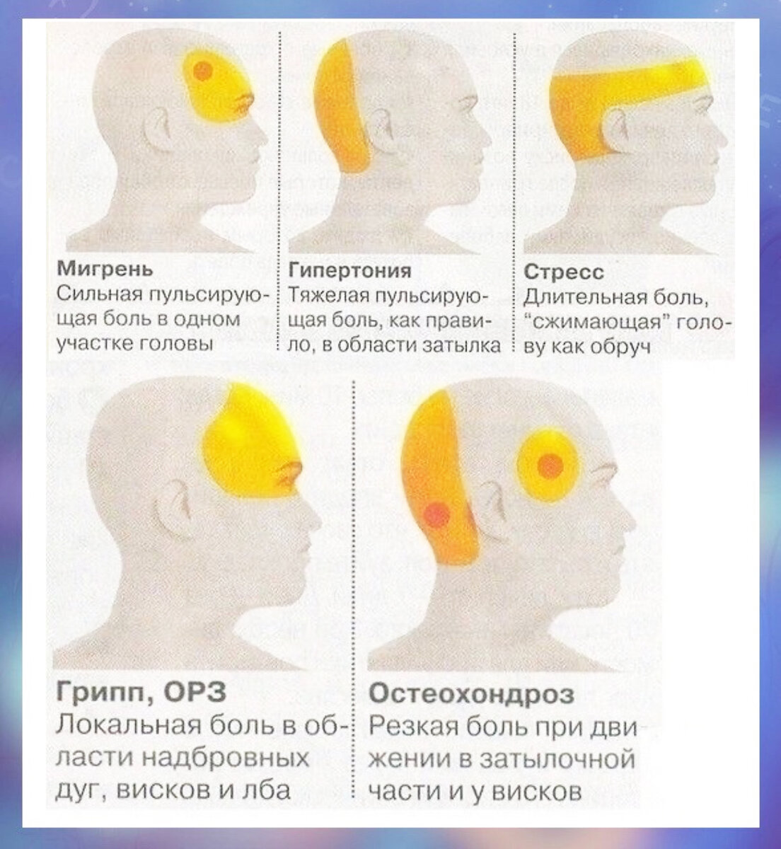 Головная боль. Что нужно знать и как разобраться? | Лаборатория йогатерапии  | Дзен