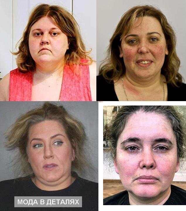 Запущенная внешность