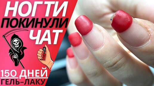 Дизайн ногтей | Интернет-магазин гель-лаков FRENCHnails - купить все для маникюра в Москве