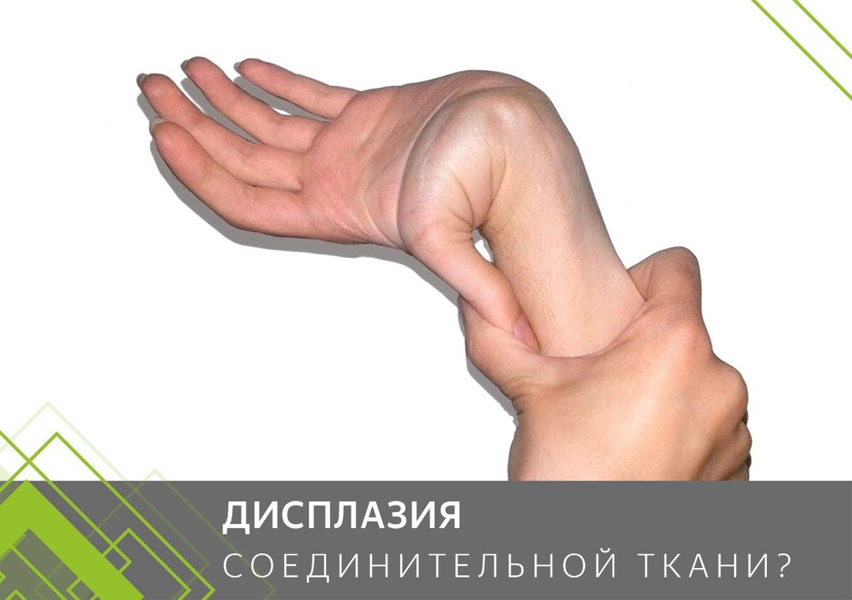 Дисплазия тканей