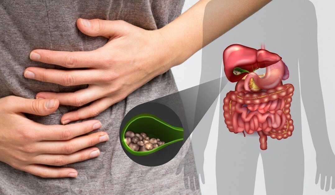     При подозрении на нарушение функции желчного пузыря назначают УЗИ органов брюшной полости — печени, желчных протоков, желчного пузыря, селезенки и поджелудочной железы. Фото: Unsplash