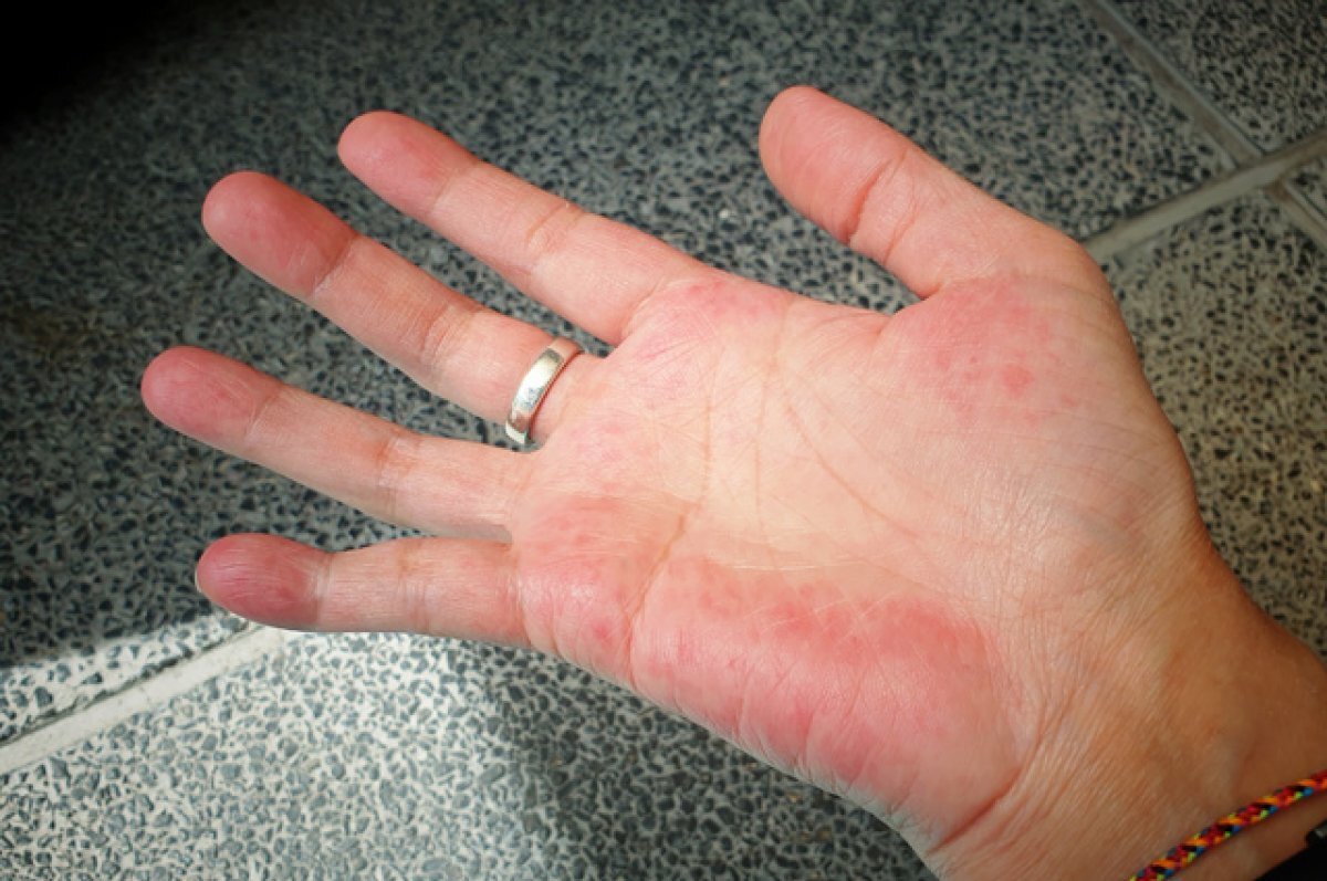    Гадаем по рукам. Что собой представляют «печеночные ладони»?