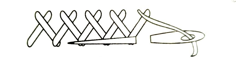 Шов "козлик"