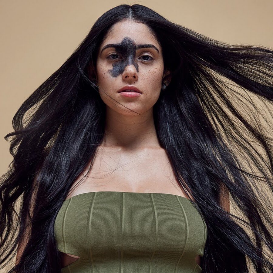 Красные винные пятна (пламенеющий невус) 