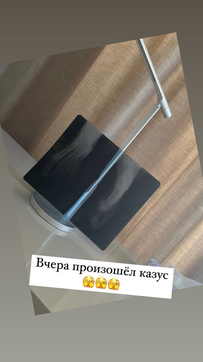    Алена показала рентгеновский снимокСоцсети Алены Шишковой