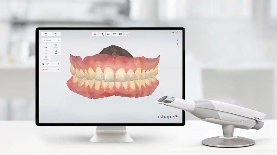 Интраоральный сканер 3Shape в Феодосии в стоматологии Улыбка
