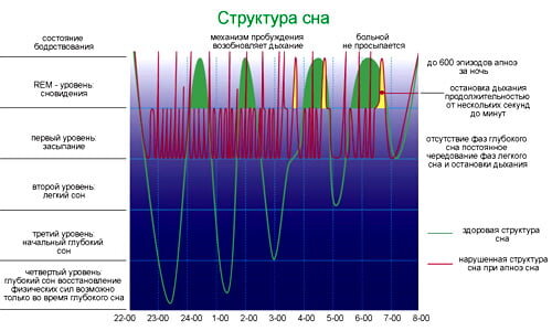 Почему больным необходимо постоянное сновидение: научное объяснение