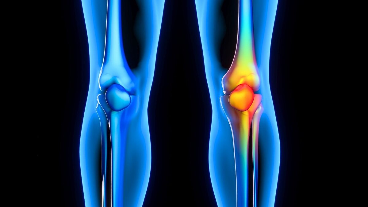 Давайте честно, колени болят, потому что ты много весишь, а не потому что весь день на ногах.