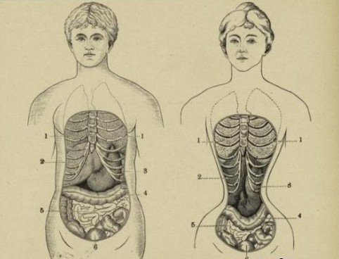 «Почему вышли из моды корсеты, которыми затягивались дамы в 19 веке?» — Яндекс Кью