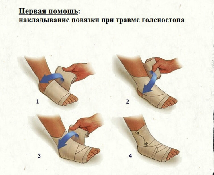 Ушиб голеностопного сустава карта вызова скорой медицинской помощи