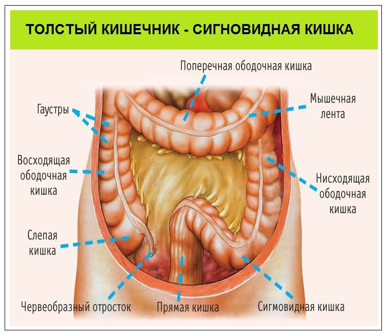 Спазм анального сфинктера