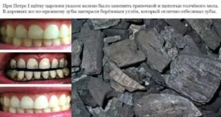 Современное отбеливание зубов проводится с помощью намного более щадящих и эффективных технологий.