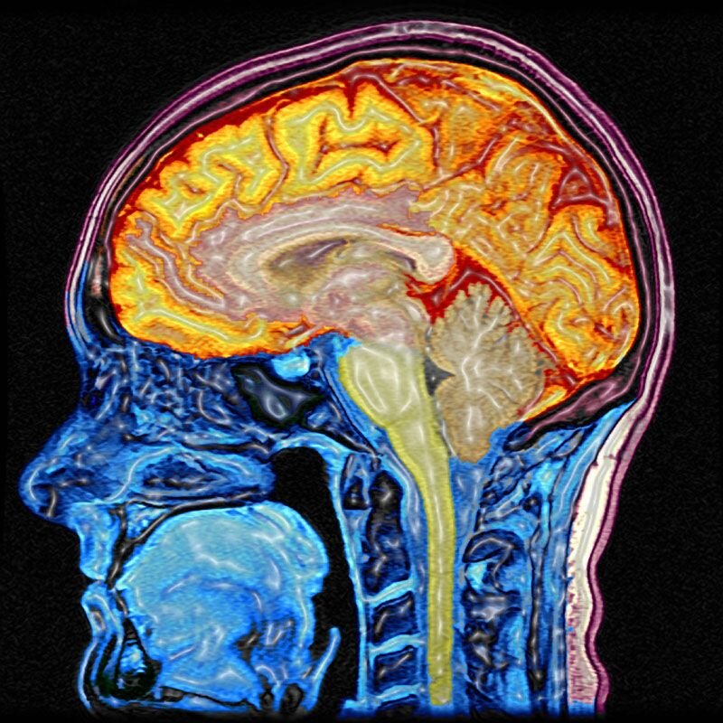 Снимки мозга. Цветное мрт мозга. Цветные снимки головного мозга.