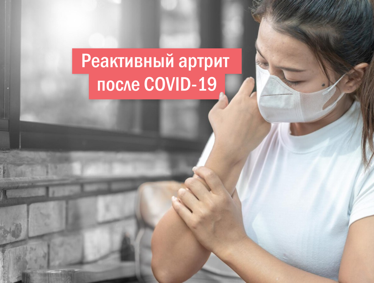 Реактивный артрит после COVID-19: симптомы, лечение и профилактика |  Скандинавский Центр Здоровья | Дзен