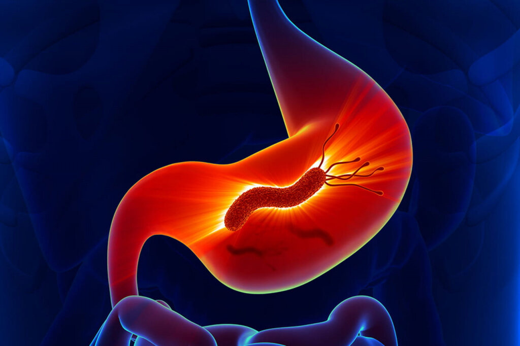 Рис.: aptstore.ru