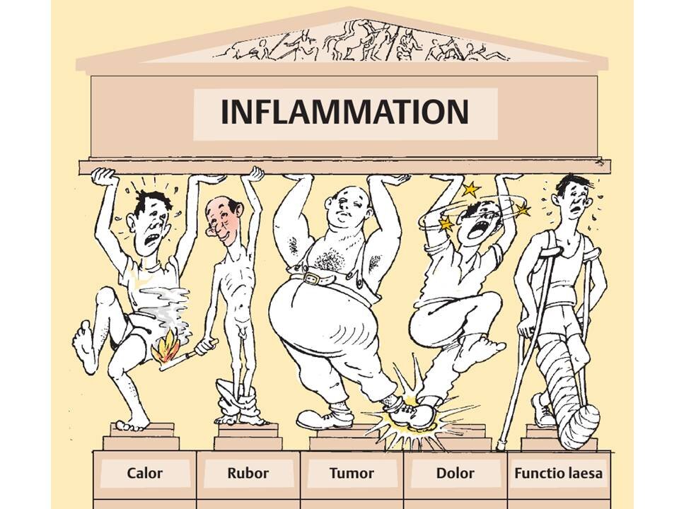 Местные проявления воспаления. Источник: Яндекс