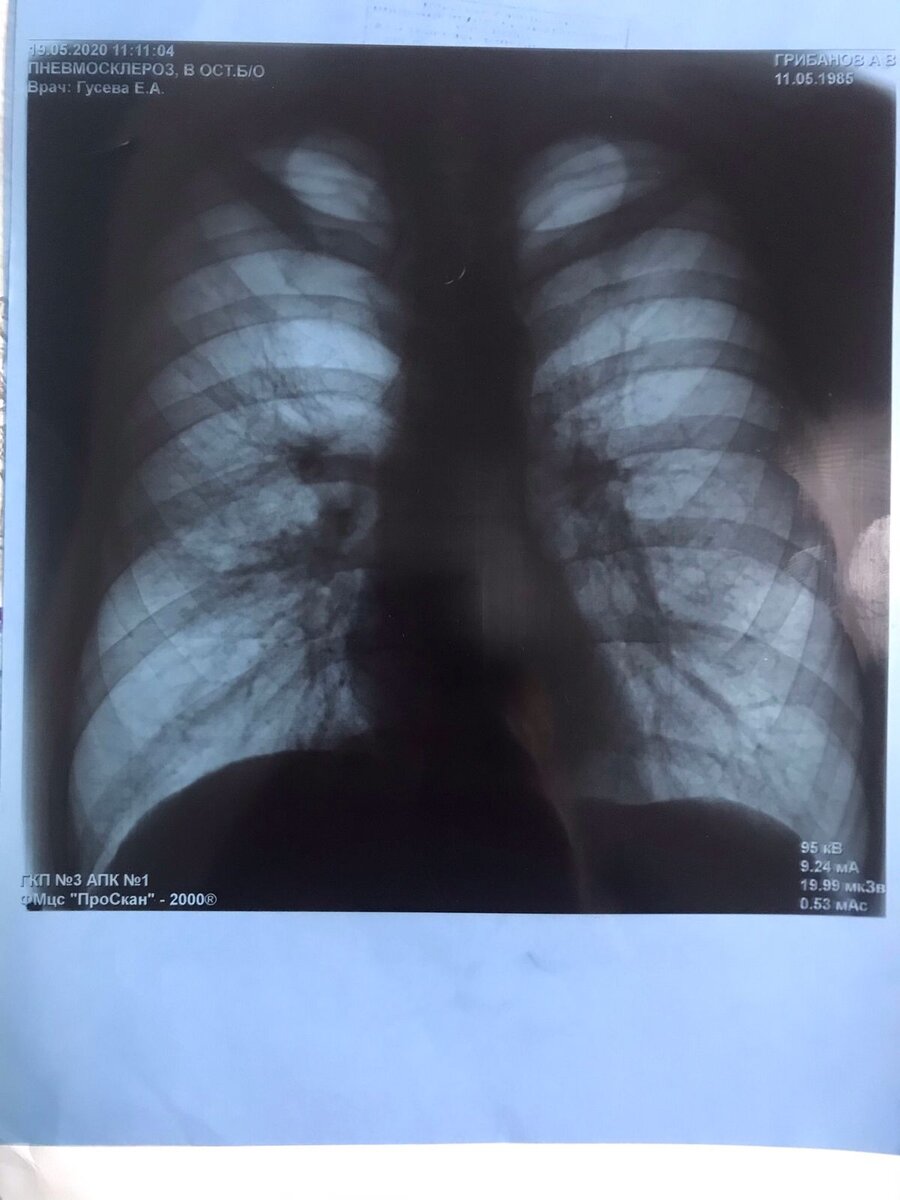 Фото взято не из открытых источников. Это прям мой снимок, но до болезни... за пол года до.