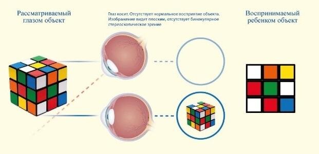 Развитие зрения у ребенка с рождения до 1 года.