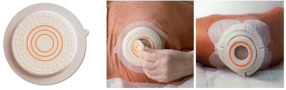 Пластырь от пролежней