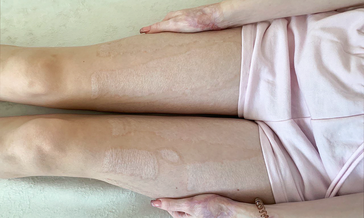 Кира Краснова, подопечная фонда "Алёша"