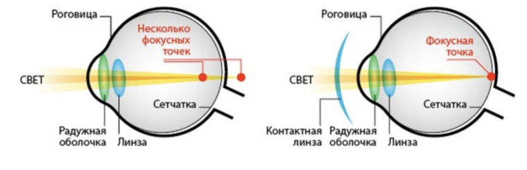 Сколько носят линзы