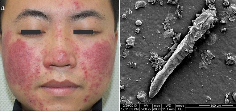 Фото: Ran Yuping et al.