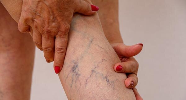 Источник - https://vascul.ru/articles/vascular-bypass-surgery