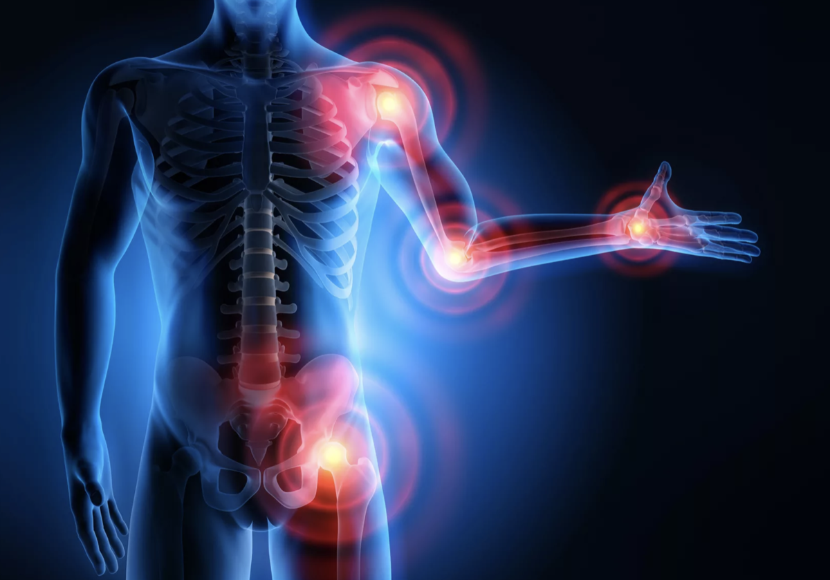 Хондрогард - спасение для суставов. Александр Шумов