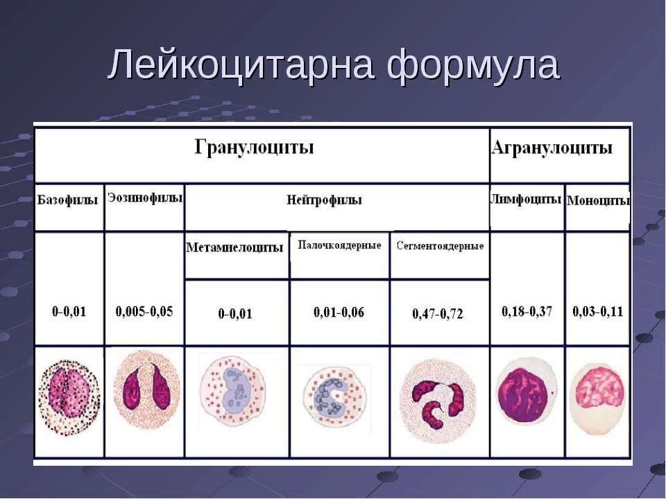 Показатели лейкоцитарной формулы крови. Лейкоцитарная формула нейтрофилы. Лейкоцитарная формула крови гистология. Бактериальная инфекция лейкоцитарная формула.