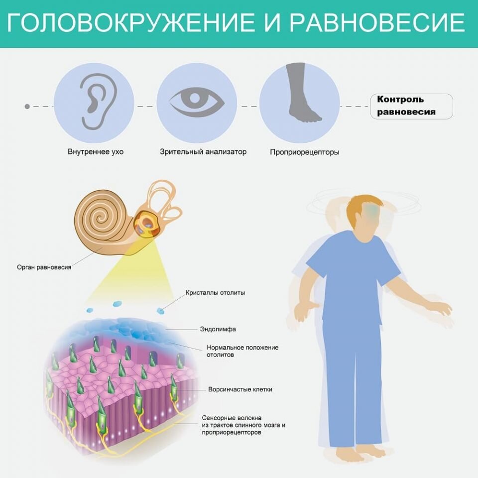 Головокружение - причины, симптомы и диагностика, показания для обращения к врачу