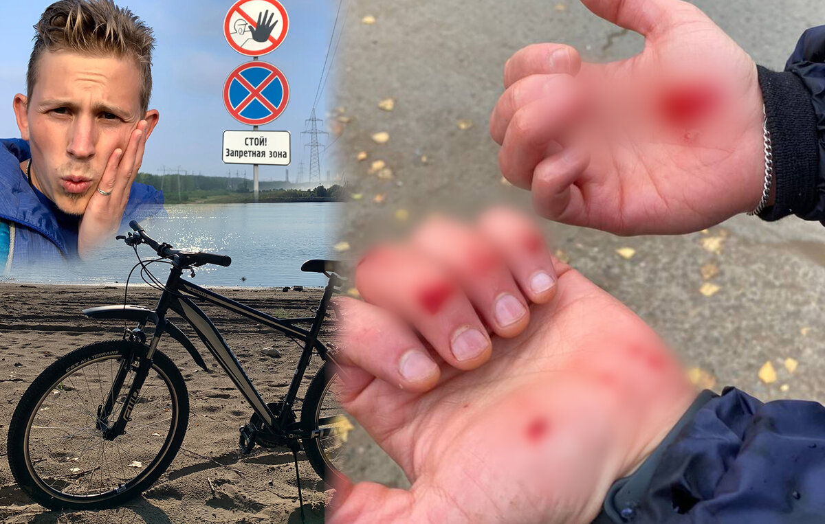 Мои руки. Немного замазал, чтобы не пугать никого =)