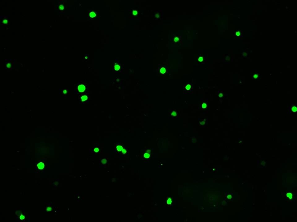 Рисунок 1. Клетки с эктопической экспрессией гена зеленого флуоресцентного белка GFP.