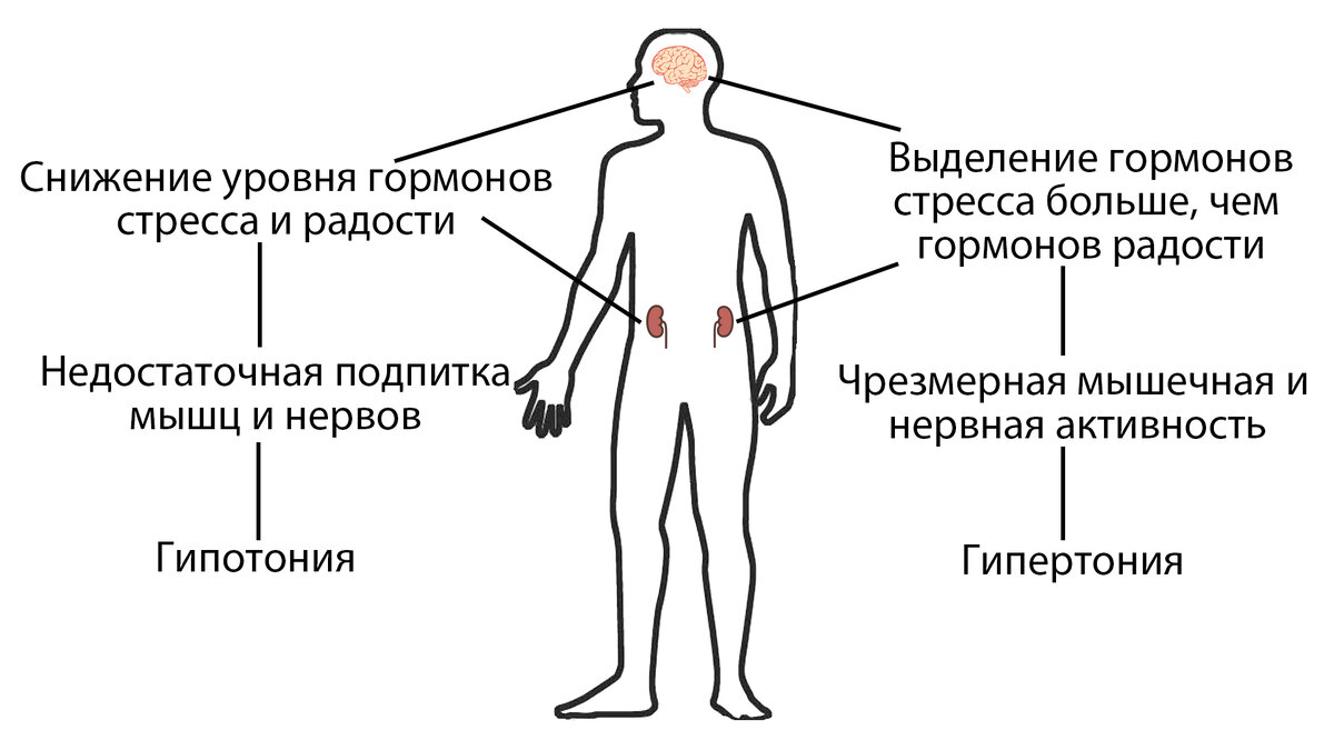 Схема влияния гормонов стресса на повышенное и пониженное АД 