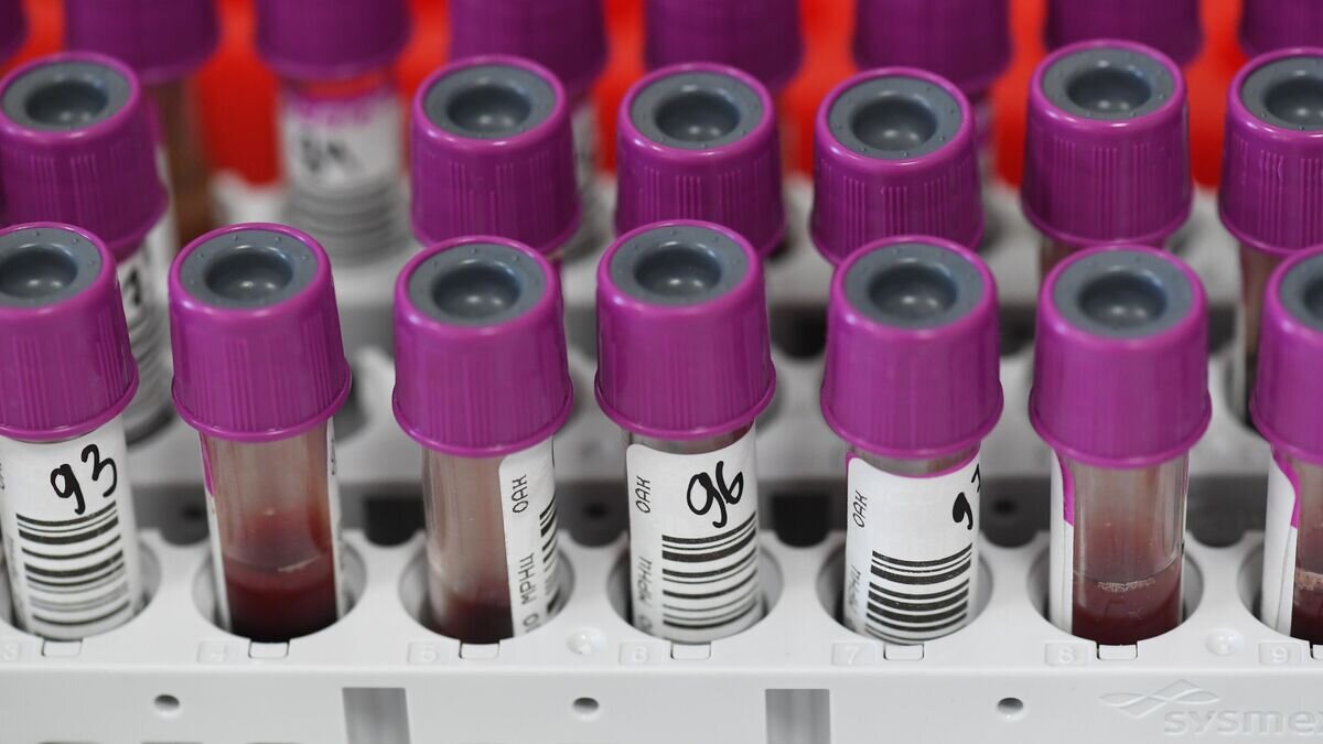    Пробирки с кровью пациентов в лаборатории по исследованию биохимического анализа крови© РИА Новости / Сергей Пятаков