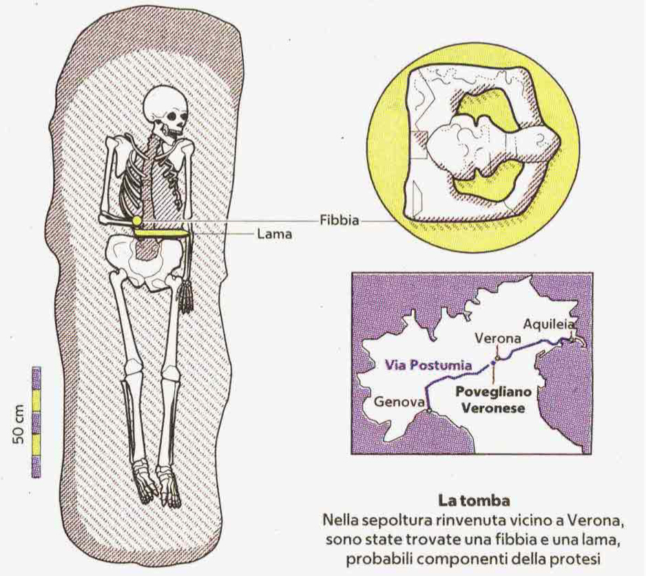 На рисунке: Lama - лезвие ножа, Fibbia - пряжка.