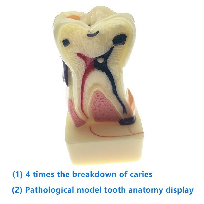 Анатомическая модель зуба