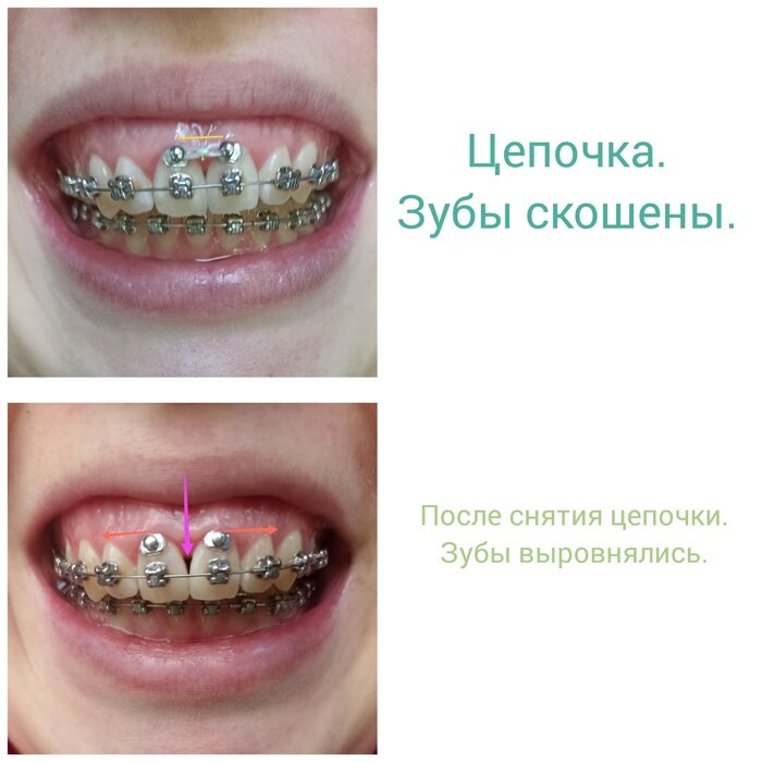 Листайте вправо, чтобы увидеть больше изображений