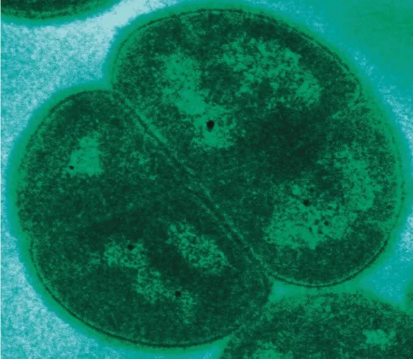 Deinococcus radiodurans, который является микробом, также известным как бактерия Конана. 