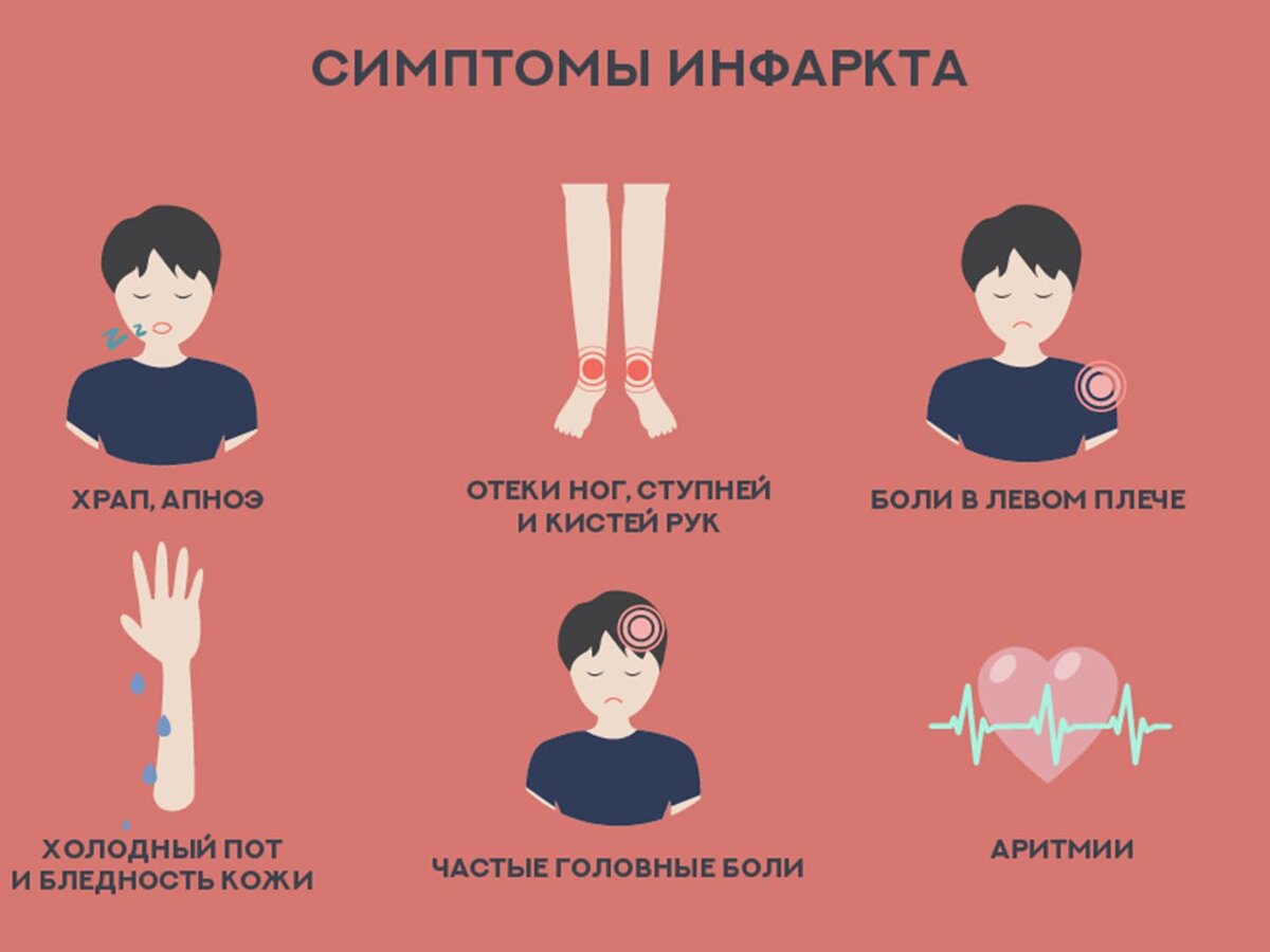 Симптомы инфаркта миокарда. Симптомы при инфаркте миокарда. Ранние симптомы инфаркта миокарда. Инфаркт миокарда симптомы у женщин. Ранние симптомы инфаркта миокарда у женщин.