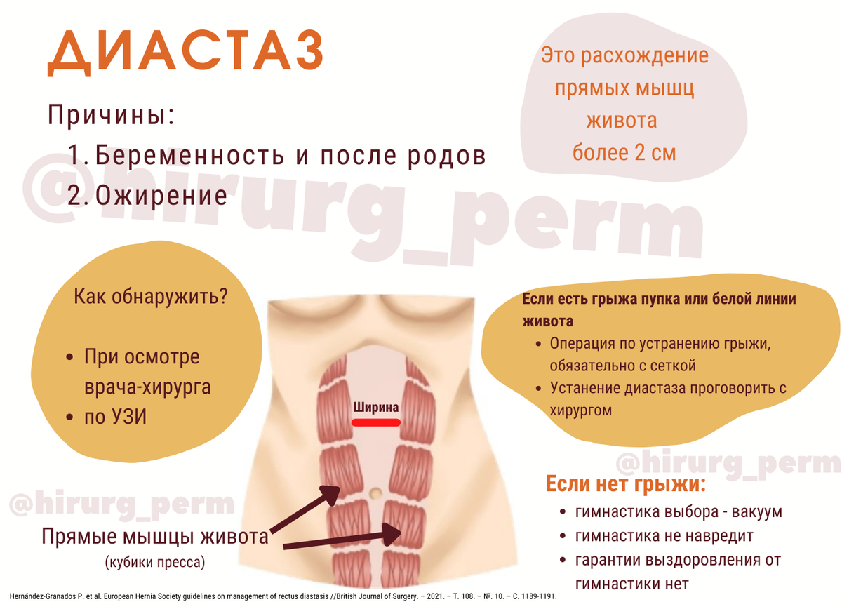 Диастаз - инфографика