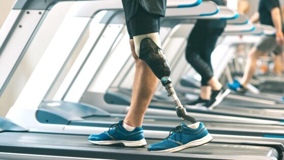    Президент РФ поручил кабмину рассмотреть вопросы о развитии производства протезов Анна Оленькова