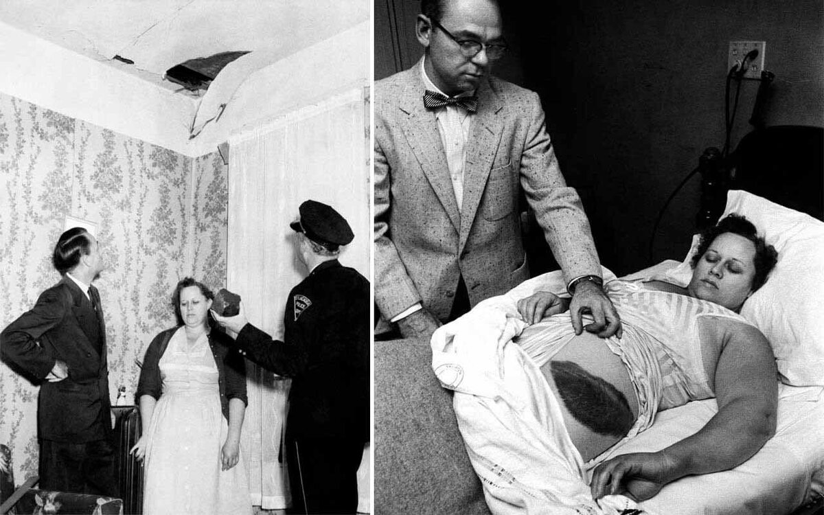 Тот самый "синяк". Источник: Яндекс.Картинки